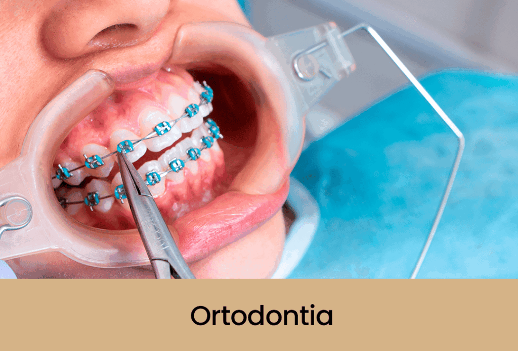 Ortodontia